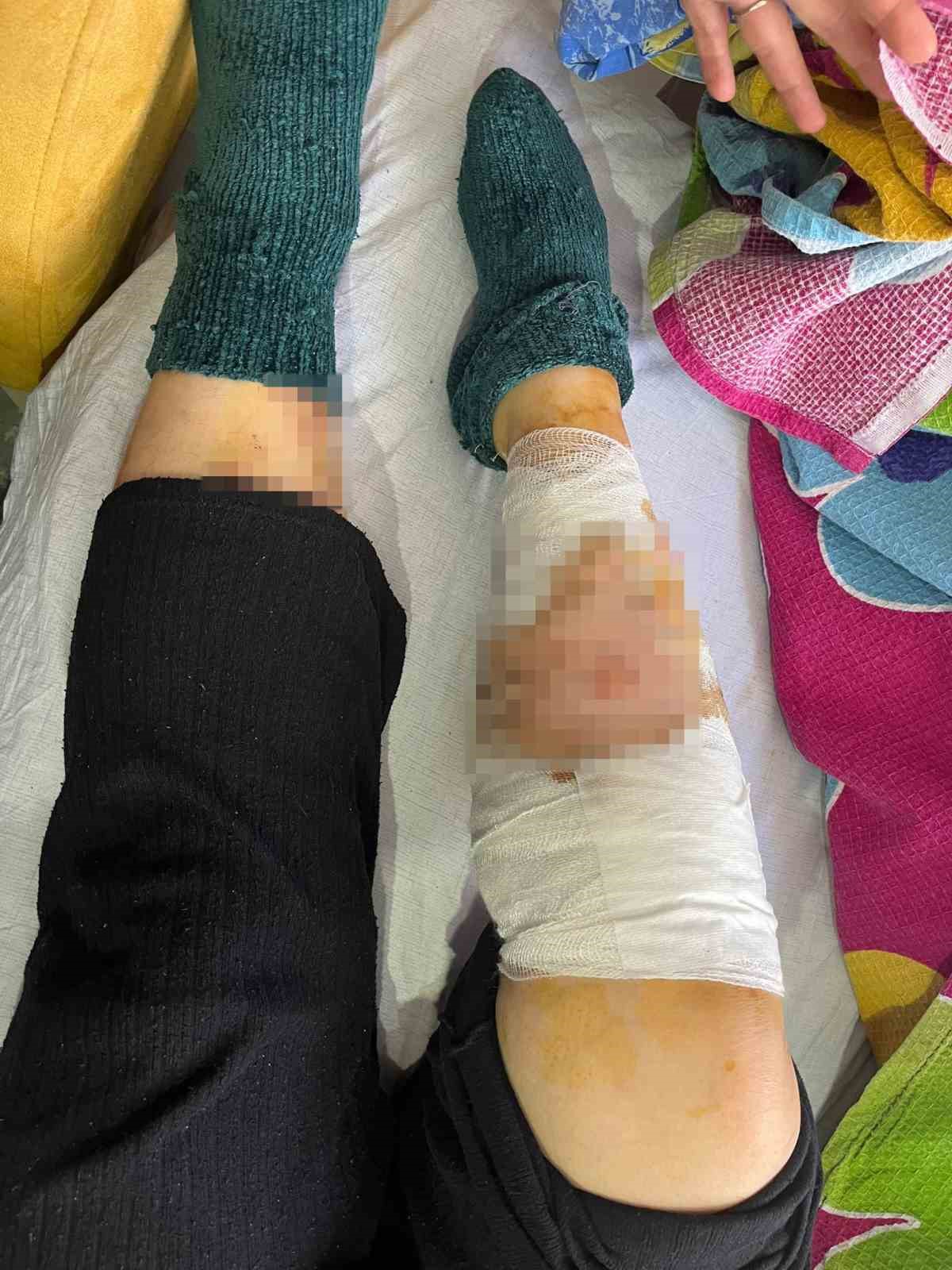 kopek surusunun saldirisinda agir yaralanan yasli kadin kolumu elimi basimi ve bacagimi parcaladilar 3 maMm4cZN