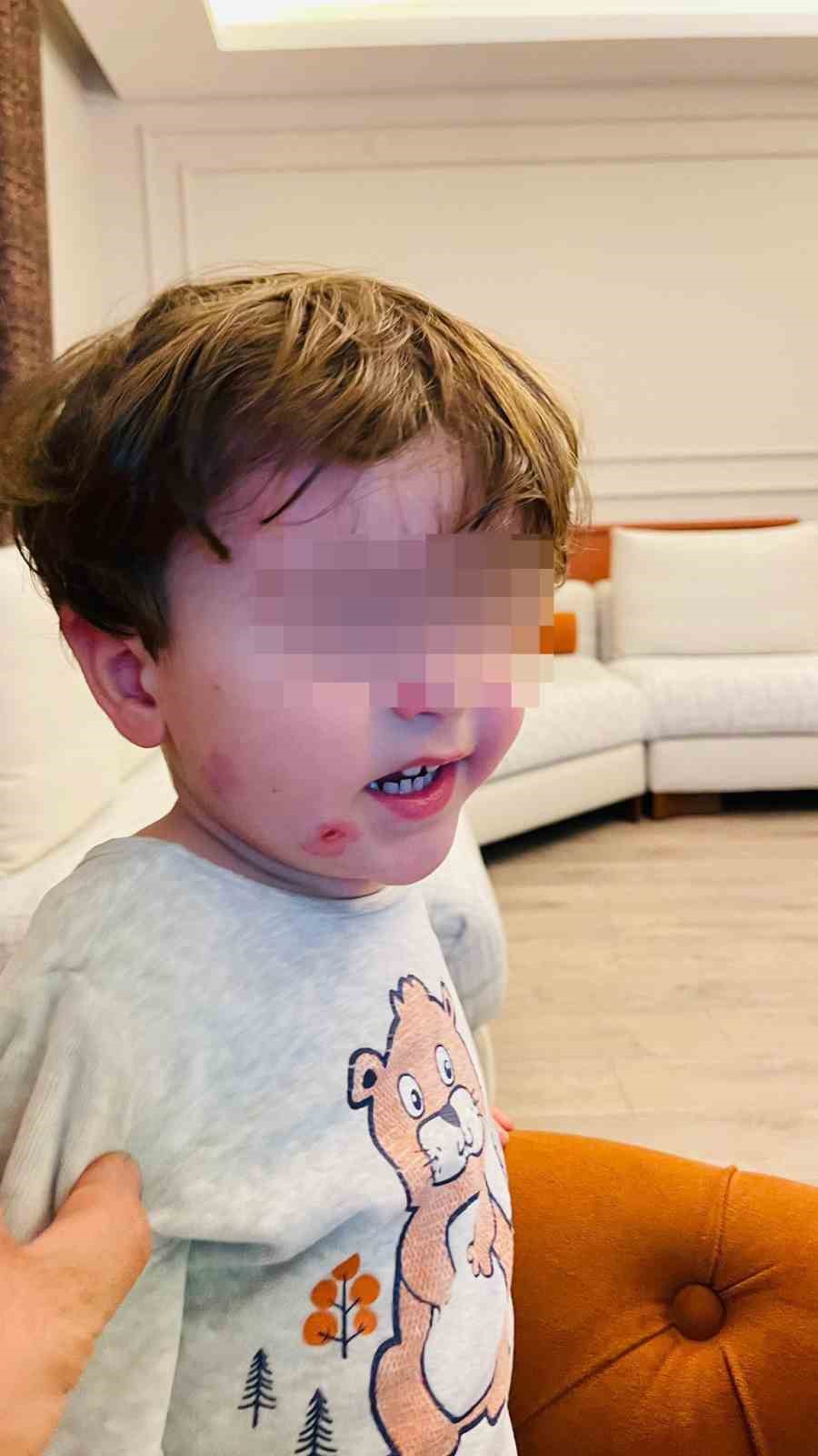 krese biraktigi cocugunu darp edilmis halde aldi 2 CCDGcqPv