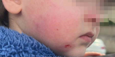 krese-biraktigi-cocugunu-darp-edilmis-halde-aldi-SRze1g6n.jpg