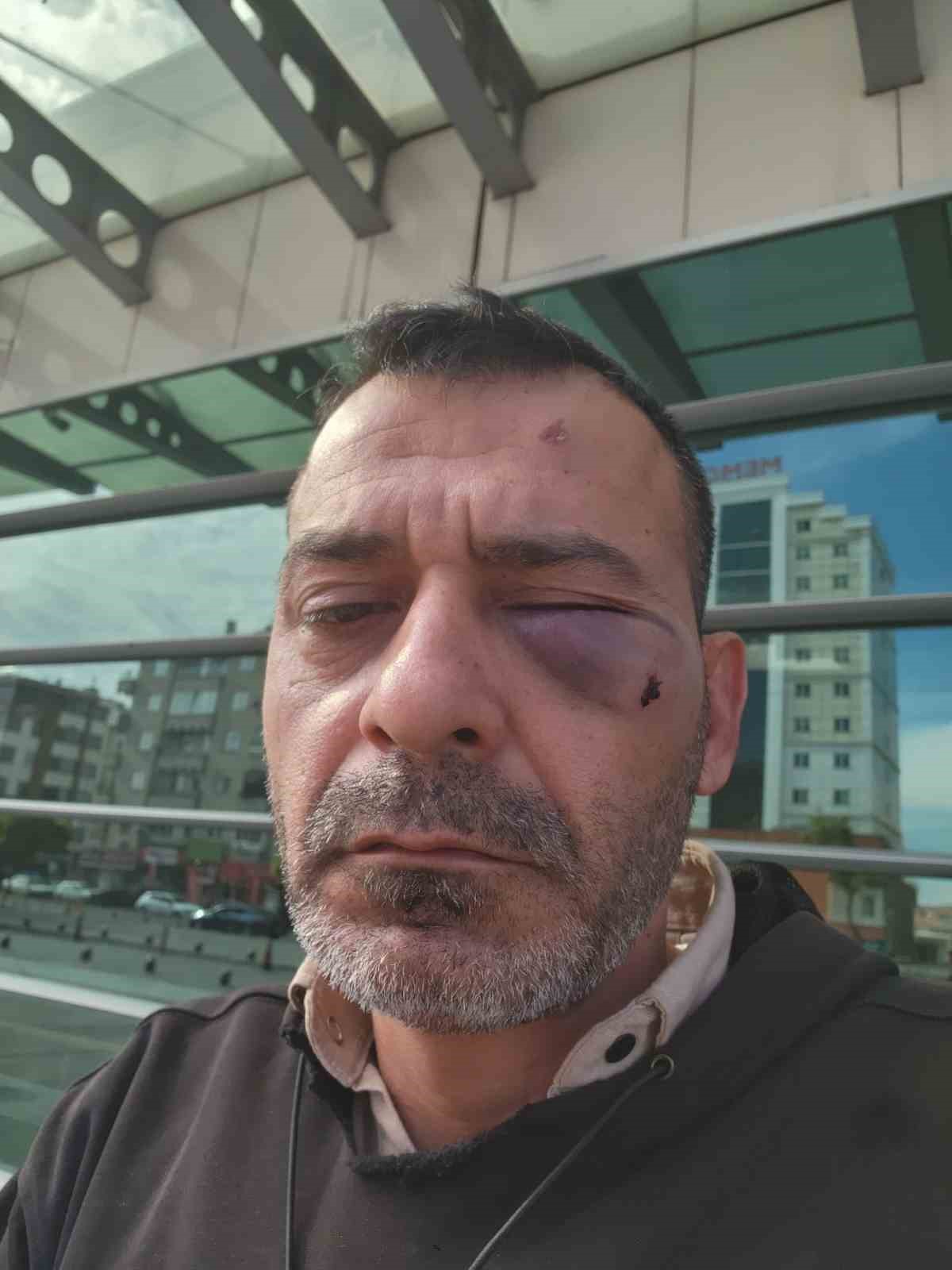 kukla sanatcisi bosanma asamasindaki esi ve ailesi tarafindan darbedildi 2 5q1N6SZN