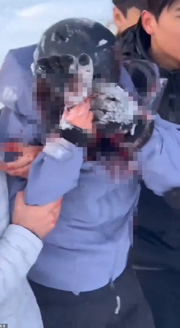 leoparla selfie cekmek istedi olumden son anda kurtuldu 2 QcgyGgHY