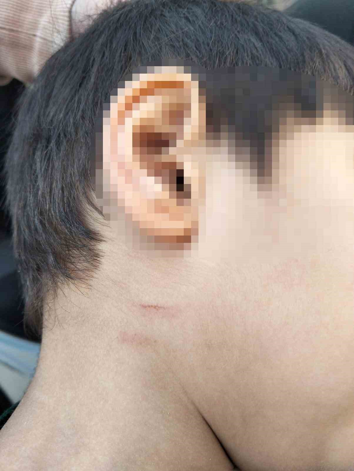 mersinde otizmli cocuga siddet kamerada ogretmen tutuklandi 5 zWnSC9EV