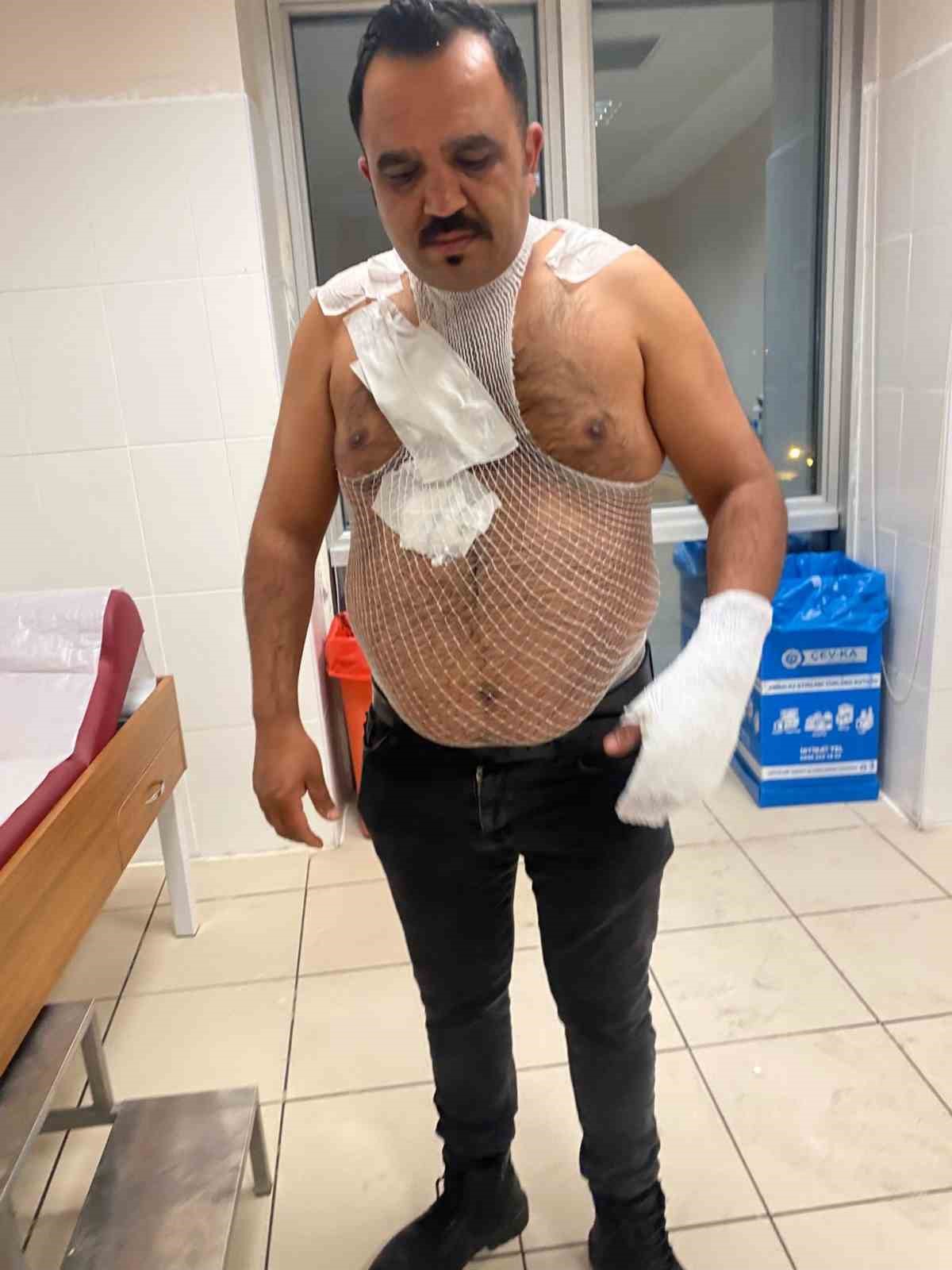 meshur tostcu soguk havada sov yapmak isterken kendini yakti 4 fV5ptqPE