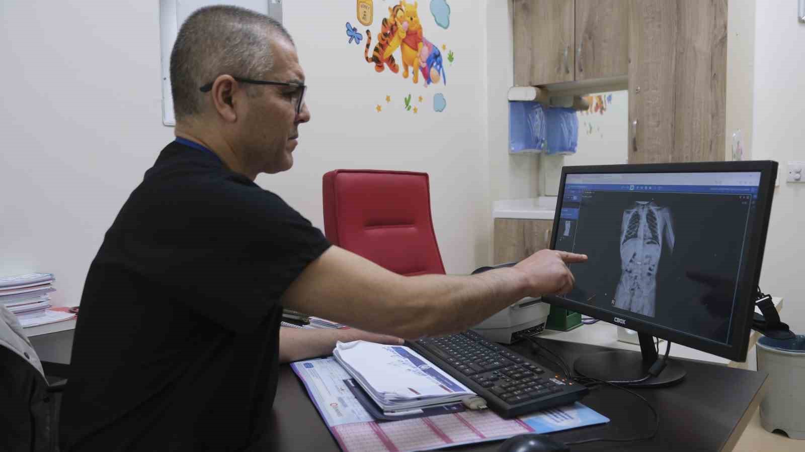 miknatis yutan cocuk ameliyatla sagligina kavustu 0 Qh6KPkLd