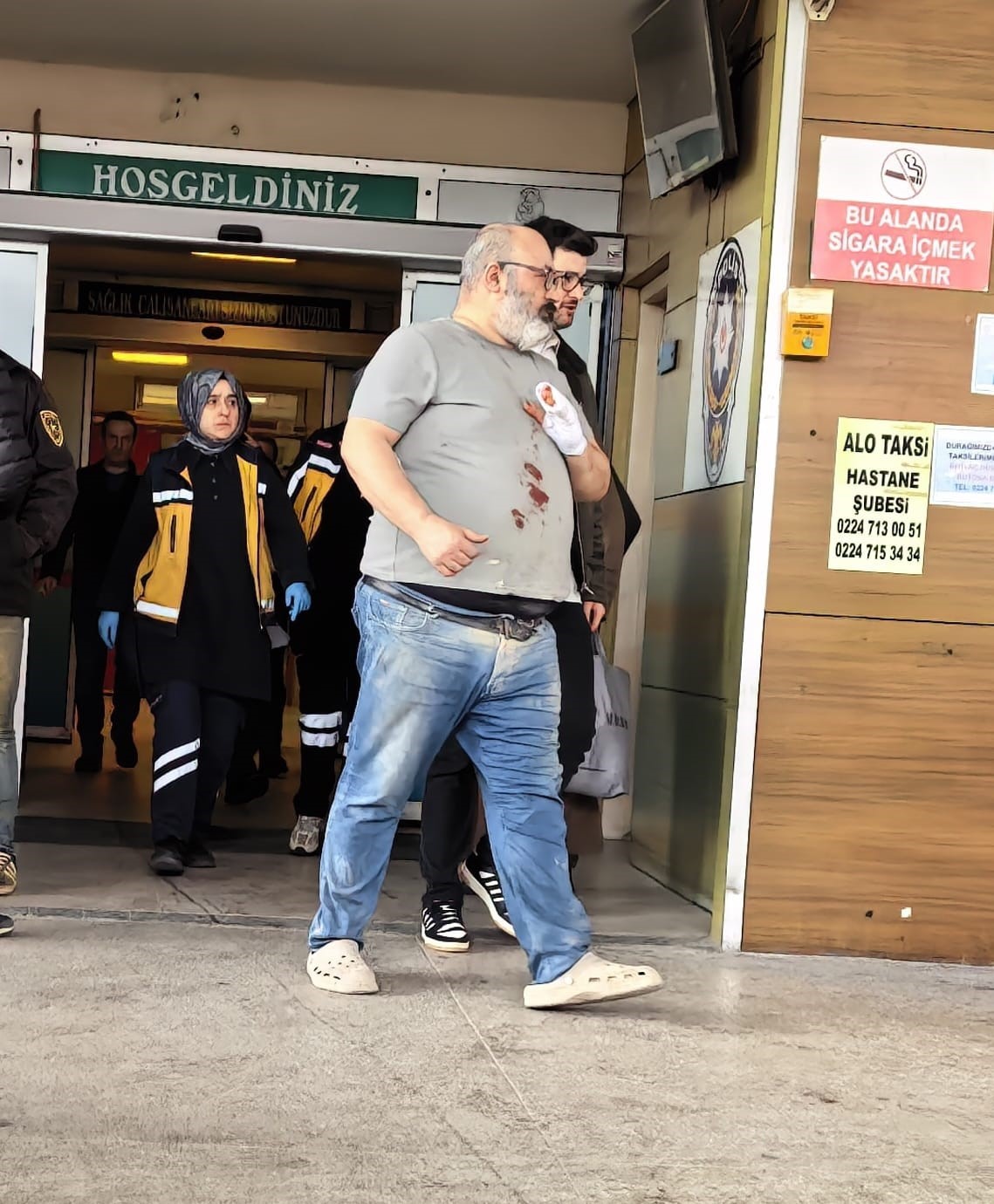 mobilya ustasi 3 parmagini frezeye kaptirdi 2 FPFnPsg2