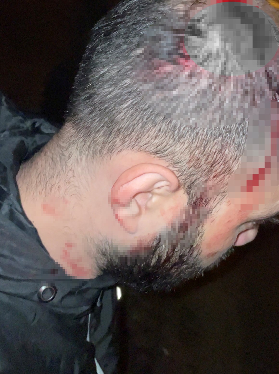 Motosikletli gence çarpıp kask kamerası görüntülerinin silindiği iddiası 7 motosikletli gence carpip kask kamerasi goruntulerinin silindigi iddiasi 3 5yCs2B2c