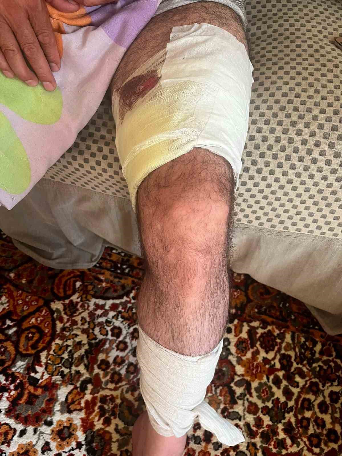muradiyede arazi anlasmazligi silahli kavgaya donustu 1 yarali 0 bpcLSUKt