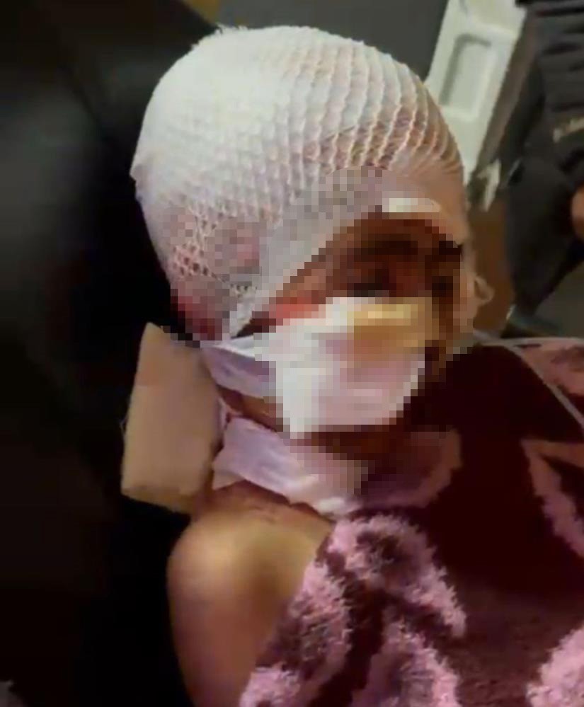 narman belediye baskani aydemir adem kinaliya sorusturma izni 0 ywlAK7RK