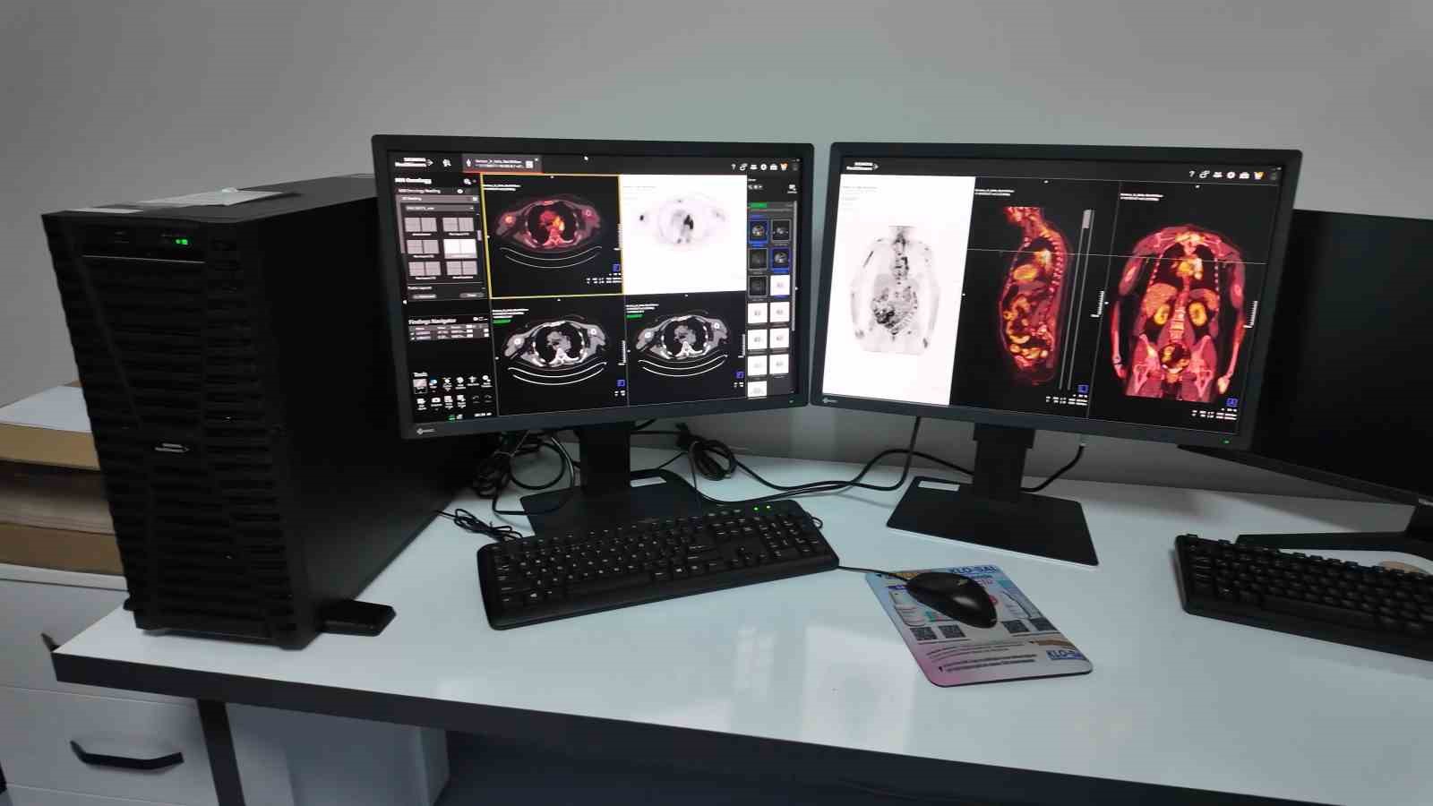 nigdeye pet ct unitesi kazandirildi 0 qhZ3QRDY