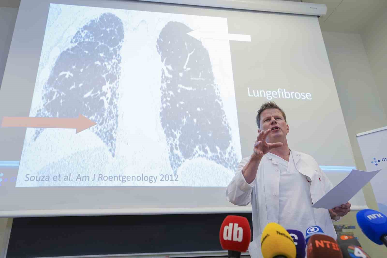 norvec veliaht prensesi mette marite akciger nakli yapildi 1 OQDC89i4