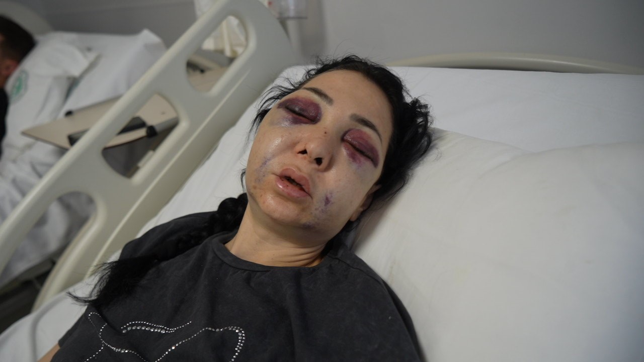 Oğlunun gözü önünde anneyi öldüresiye dövdüler: "’Küfür etmeyin’ dedik diye bu hale geldim" 4 oglunun gozu onunde anneyi olduresiye dovduler kufur etmeyin dedik diye bu hale geldim 0 SWas58j5