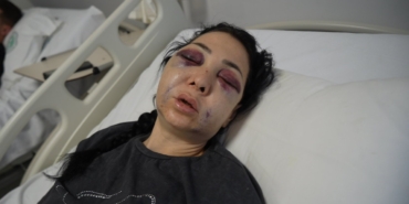 oglunun-gozu-onunde-anneyi-olduresiye-dovduler-kufur-etmeyin-dedik-diye-bu-hale-geldim-d6VisO1r.jpg