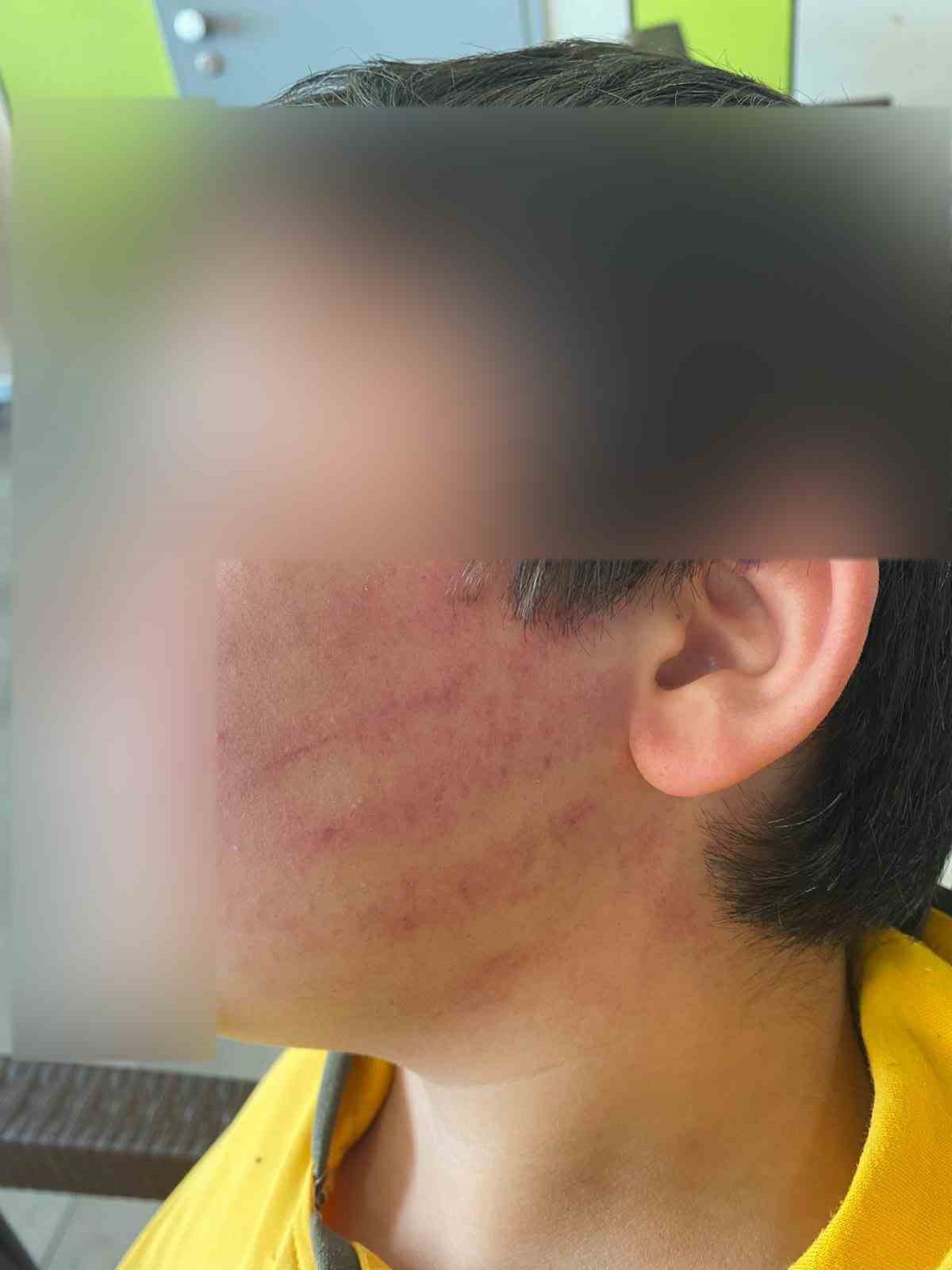 ogrencilere yonelik kullanilan firca sapi silah sayildi 3 79PfhOj8