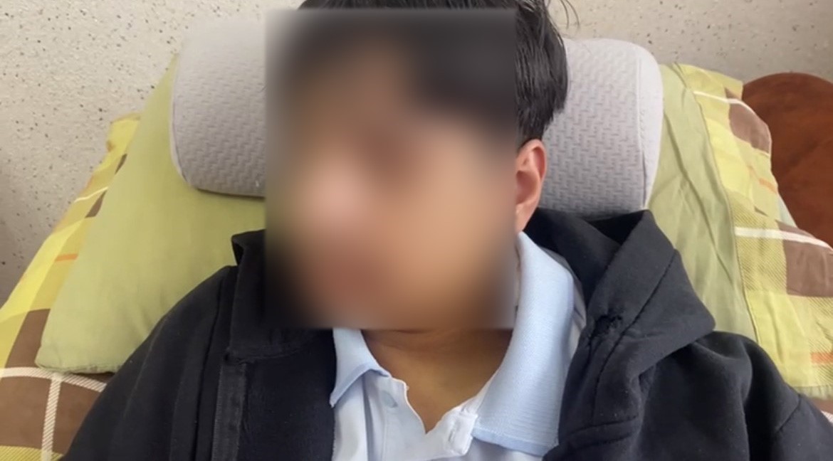 okulda akran zorbaligi iddiasi 15 yasindaki ogrencinin cenesi kirildi 1 2DSFQ8uA