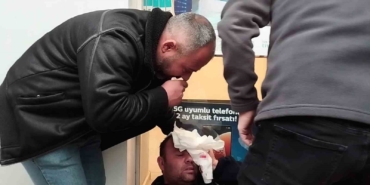 orduda-ruzgarda-dusen-tabela-kafasina-carpan-belediye-iscisi-yaralandi-LErNMgLB.jpg
