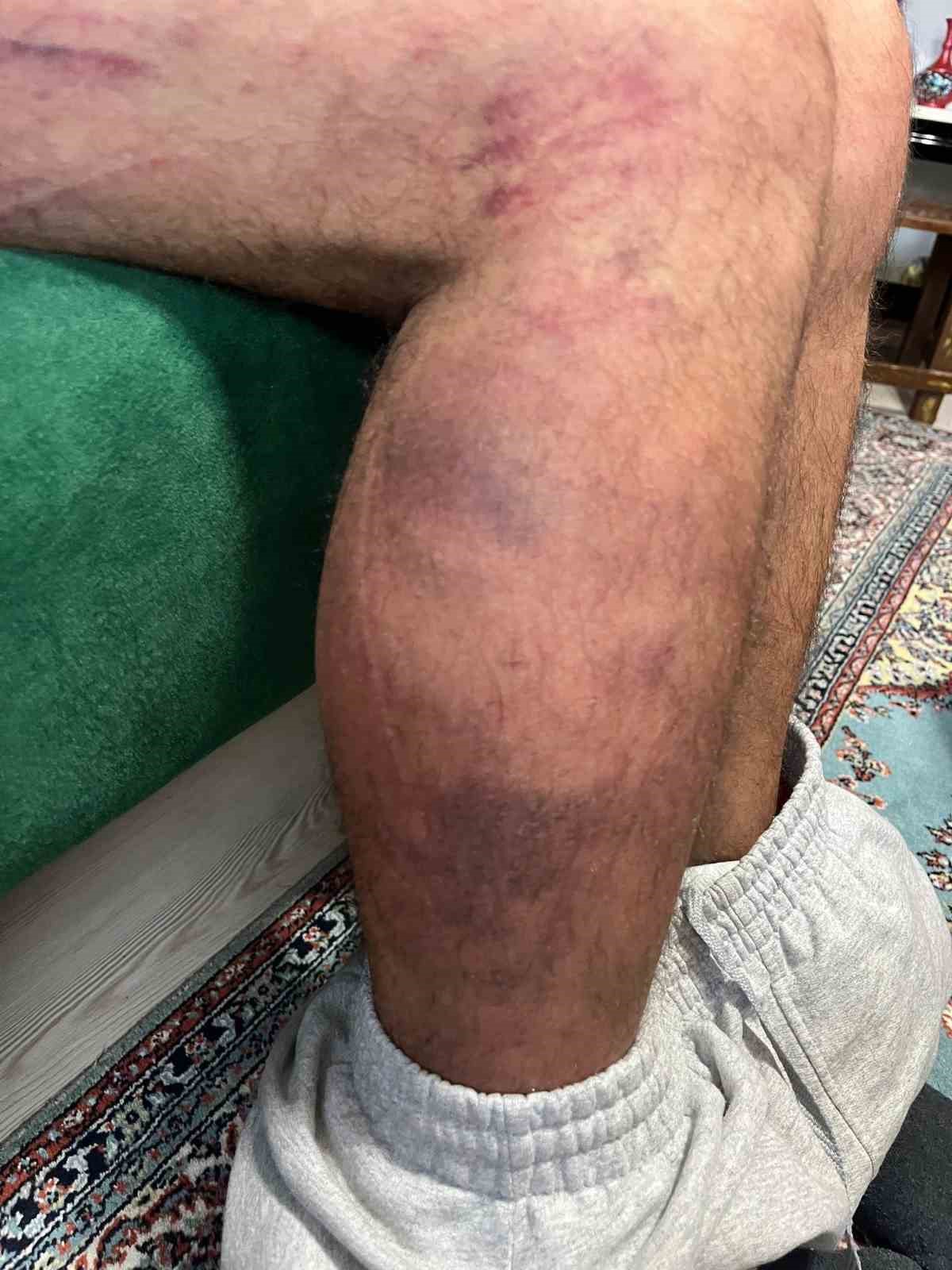 otizmli adami olduresiye darp eden sanik ilk kez konustu 6 fbasuf3f
