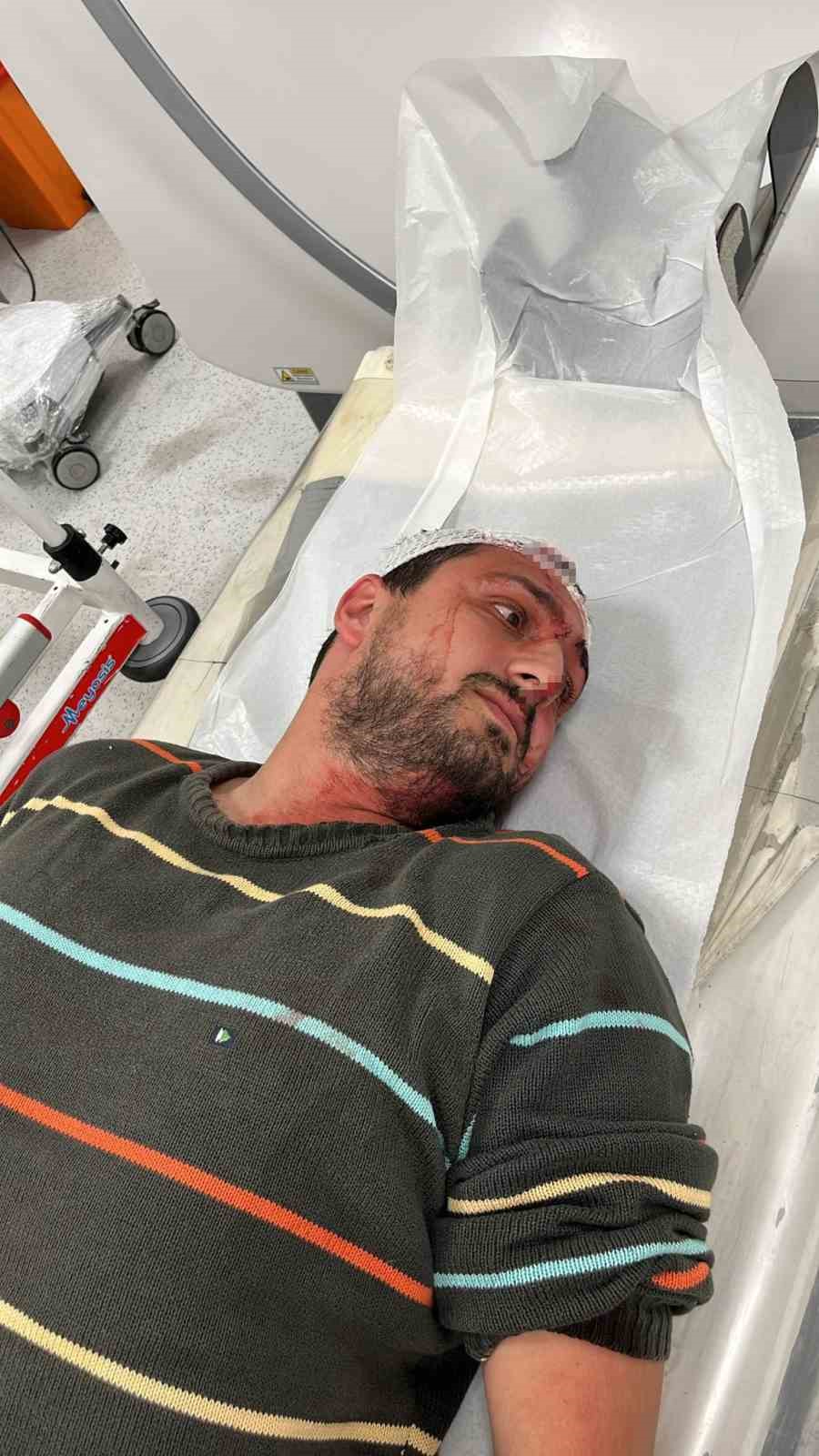otizmli adami olduresiye darp eden sanik ilk kez konustu 7 8fjTD3QT