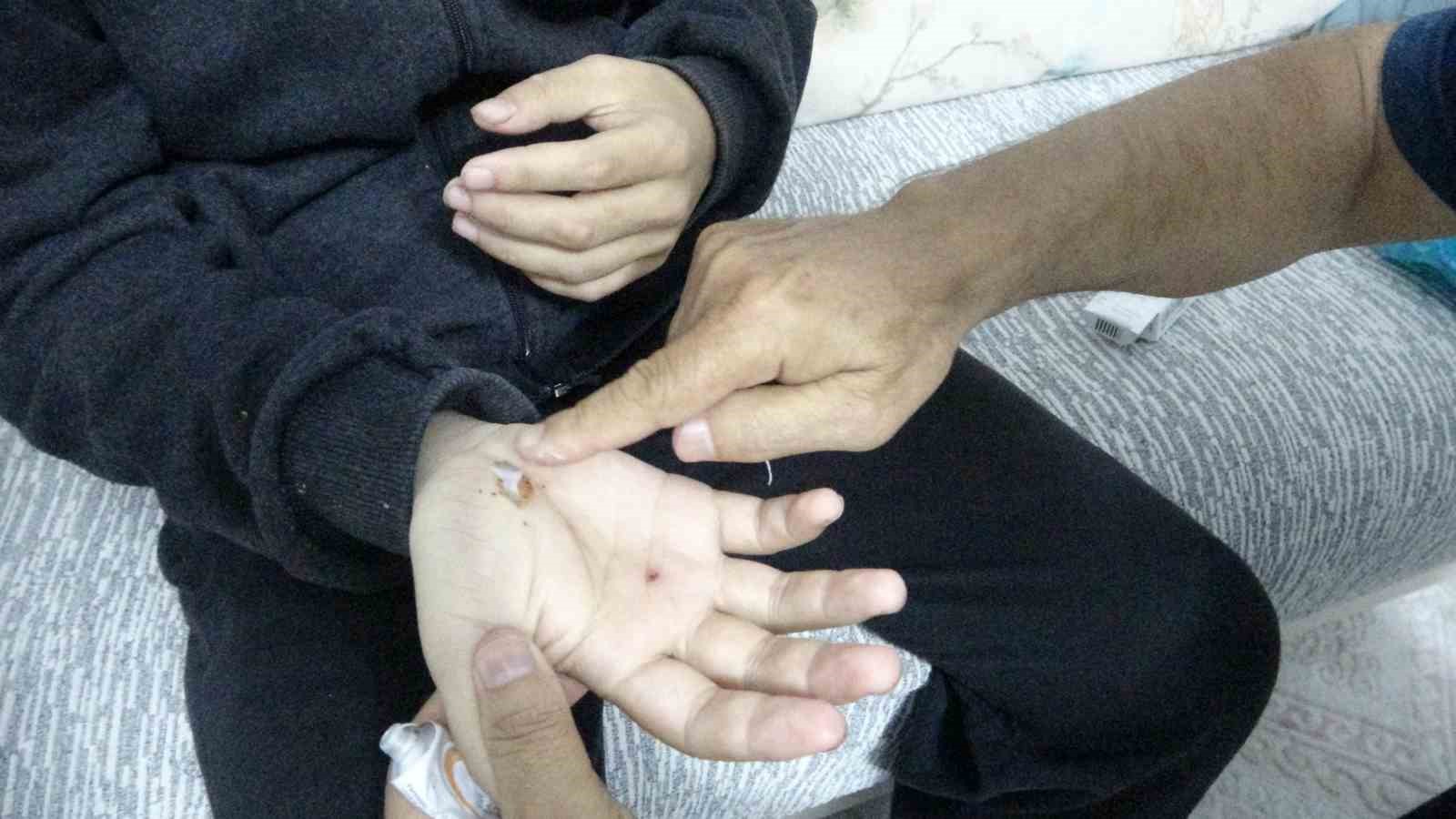 otizmli ogluyla doga gezisi sirasinda sahipli kopeklerin saldirisina ugradi 1 IZvzZBkz