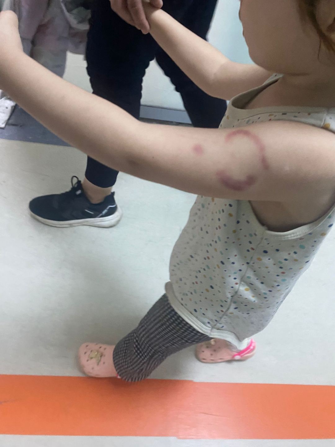 Özel kreşin öğretmeni çocuğa felaketi yaşattı: İddiaya göre öğretmen çocuğun kolunu ısırdı 8 ozel kresin ogretmeni cocuga felaketi yasatti iddiaya gore ogretmen cocugun kolunu isirdi 4 PSs8v4cf
