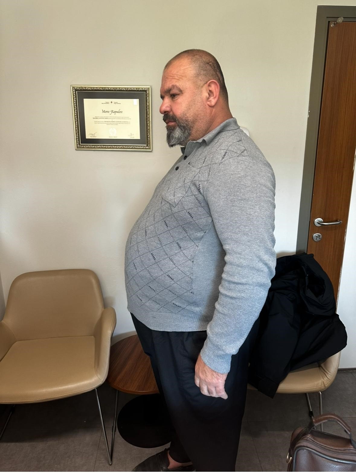 ozel sular akademi hastanesinde ozel diyetle bir yilda 52 kilo verdi 4 WsdRYnpc