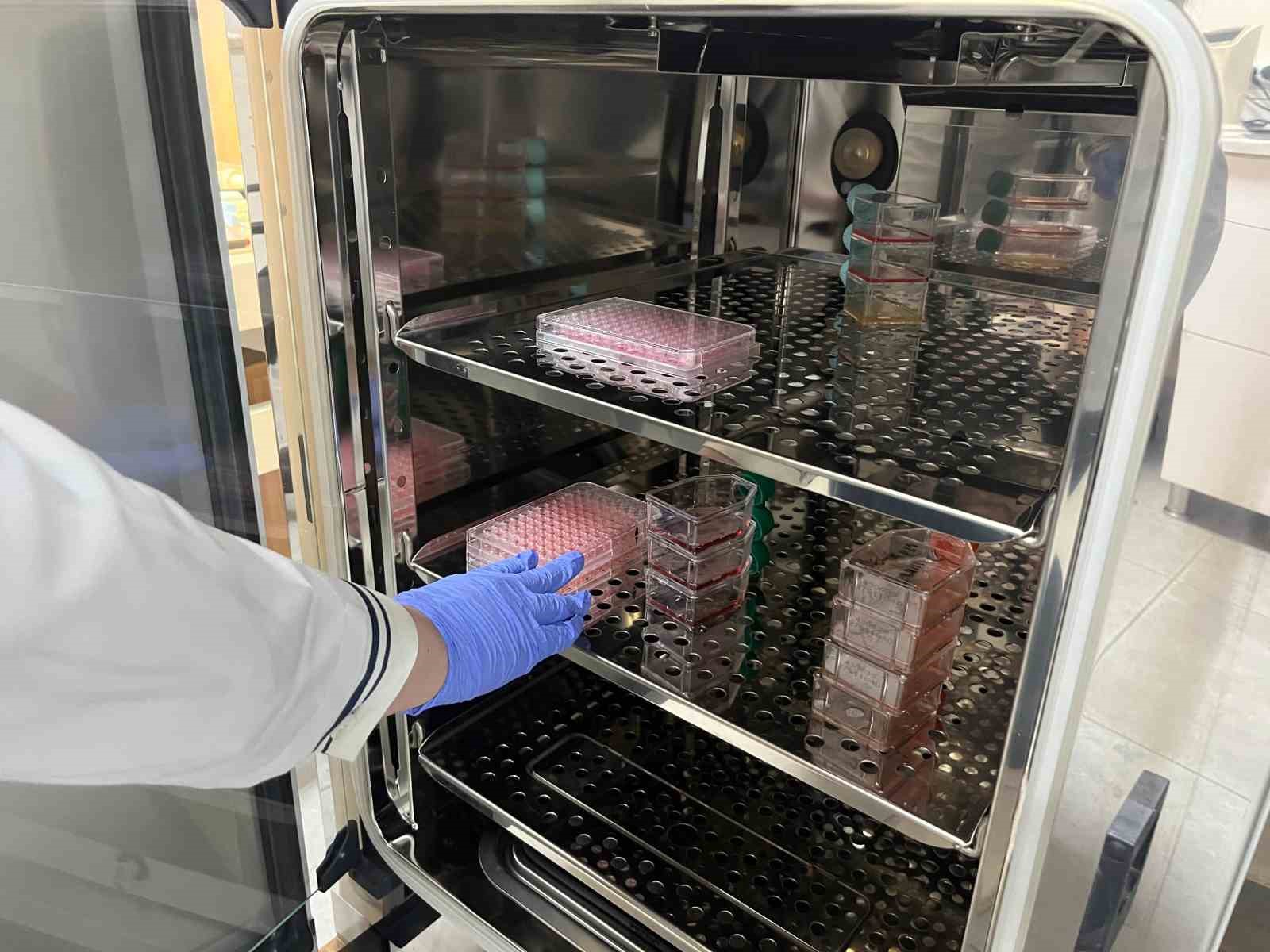 Parkinson’da bağırsak- beyin iletişimi çip üstü organ teknolojisiyle araştırılıyor 4 parkinsonda bagirsak beyin iletisimi cip ustu organ teknolojisiyle arastiriliyor 0 Hs7e6a7z