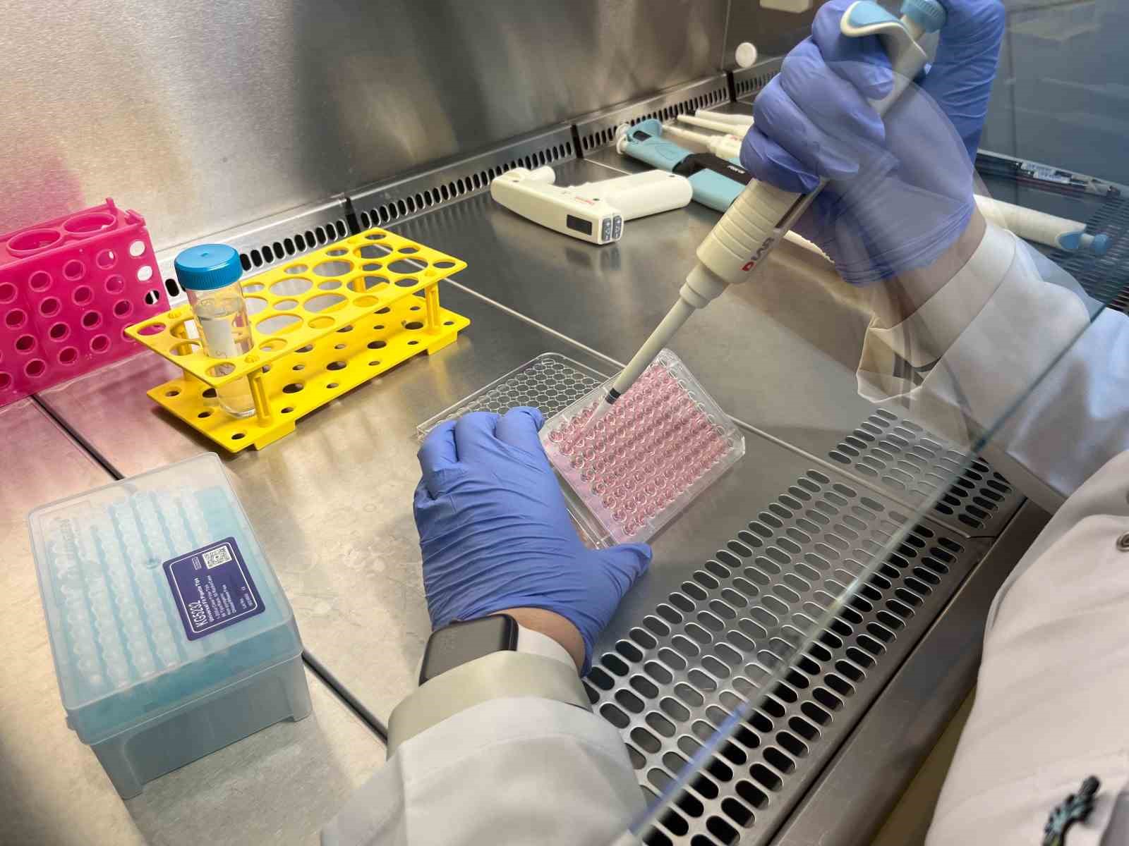 Parkinson’da bağırsak- beyin iletişimi çip üstü organ teknolojisiyle araştırılıyor 5 parkinsonda bagirsak beyin iletisimi cip ustu organ teknolojisiyle arastiriliyor 1 W65KWTb5