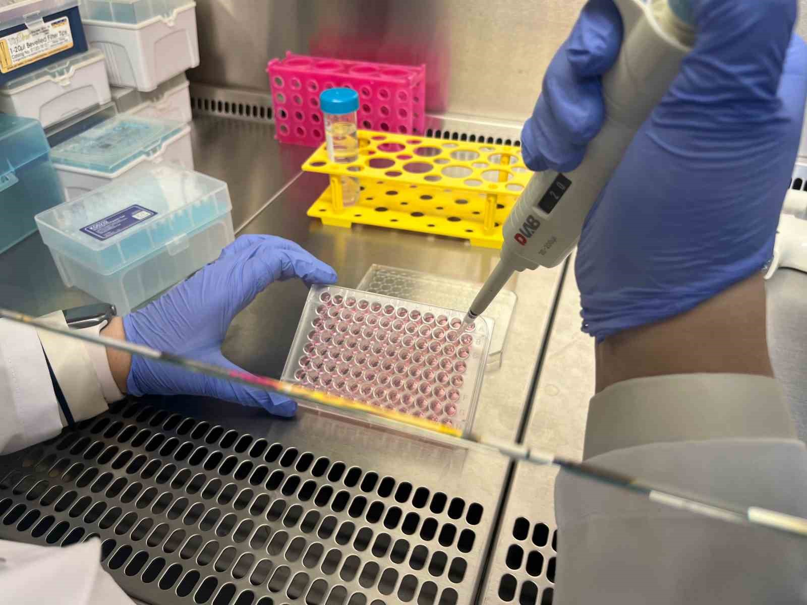 Parkinson’da bağırsak- beyin iletişimi çip üstü organ teknolojisiyle araştırılıyor 10 parkinsonda bagirsak beyin iletisimi cip ustu organ teknolojisiyle arastiriliyor 6 zZzXpH6C