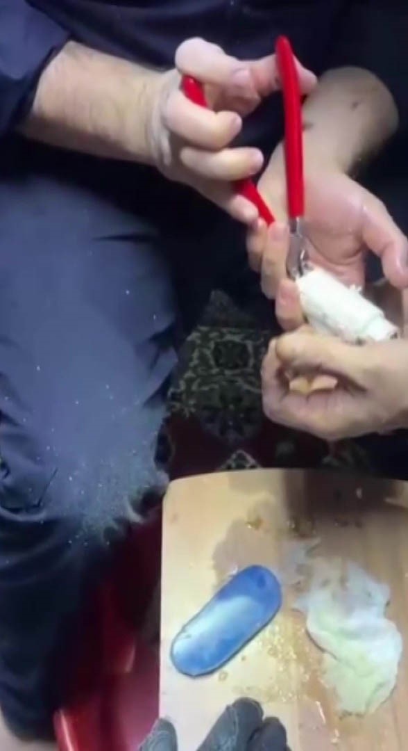 Parmağını kombi borusuna sıkıştırdı 5 parmagini kombi borusuna sikistirdi 1 qFMNyn3M