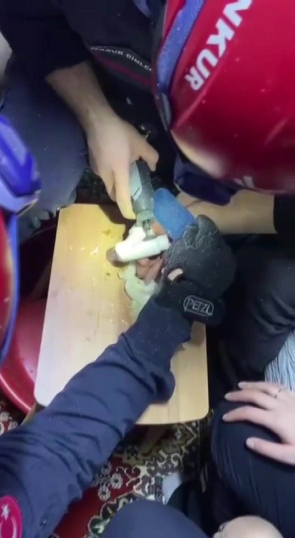Parmağını kombi borusuna sıkıştırdı 6 parmagini kombi borusuna sikistirdi 2