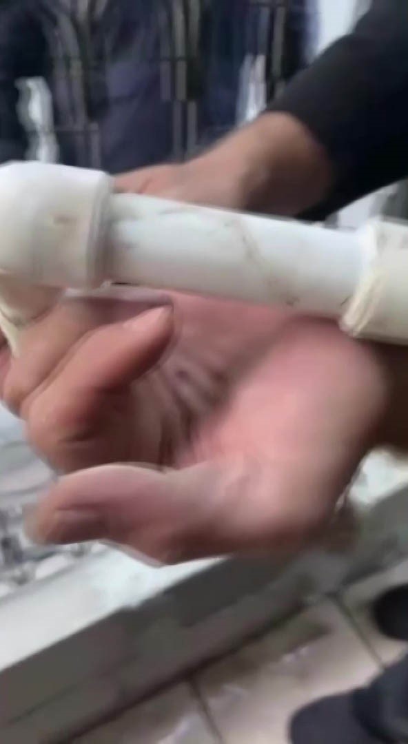 Parmağını kombi borusuna sıkıştırdı 8 parmagini kombi borusuna sikistirdi 4 UvPzpTDG