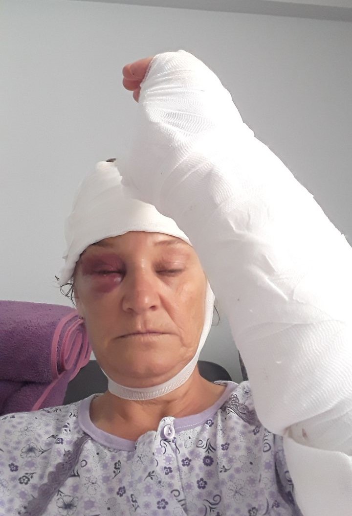 patronun kopegi dehset sacti vucuduna 80 dikis atilan kadin koruma olumden dondu 12 QSU3scbq