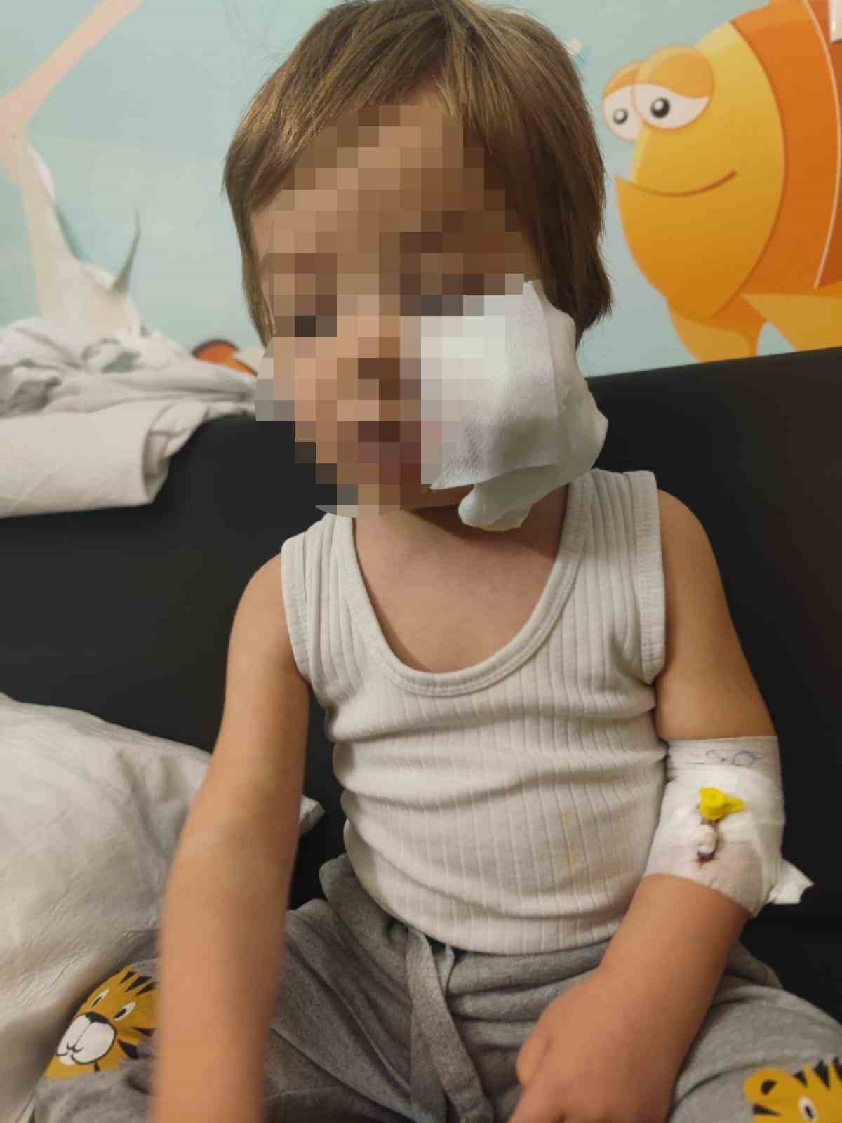 pitbull cinsi kopegin saldirisina ugrayan cocuk taburcu oldu 1 XVGs1Hg1
