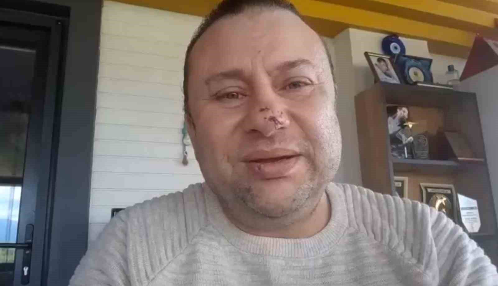 pitbull saldirisina ugrayan onur akay o anlari anlatti ben olumden dondum 0