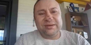 pitbull-saldirisina-ugrayan-onur-akay-o-anlari-anlatti-ben-olumden-dondum-OUuyp1cG.jpg