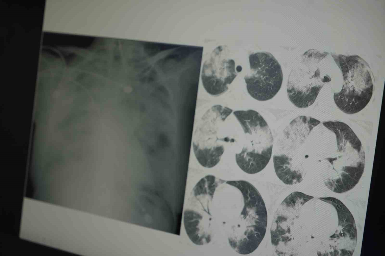 profesor acikladi hantavirus kemirgenlerden bulasiyor 2 elM45CFw