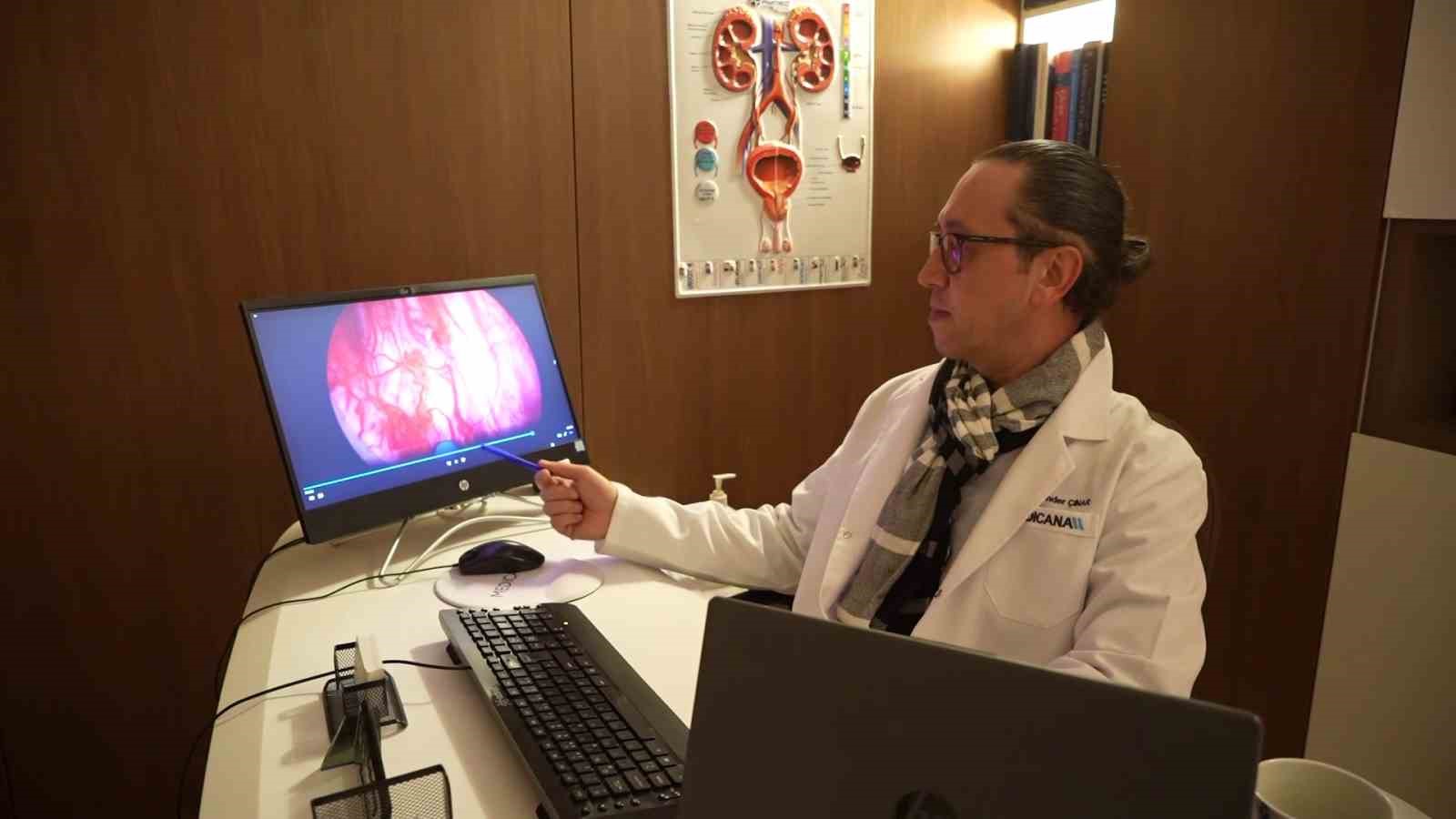 prostata holep ile kesin cozum 400 grama kadar prostat guvenle alinabiliyor 0 55jBXe7a