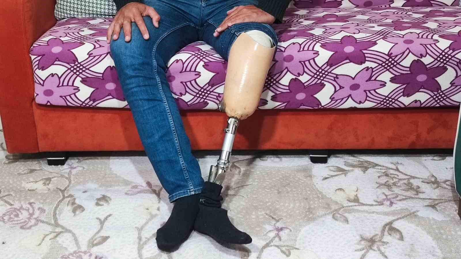 Protez bacaklı adam alacağını almak için IBAN verdi, cezaevine girip işinden oldu 4 protez bacakli adam alacagini almak icin iban verdi cezaevine girip isinden oldu 0 uKPCOmaR