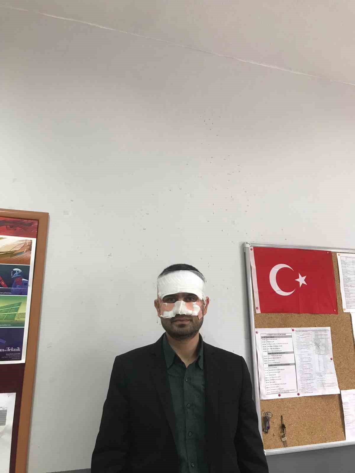 rehber ogretmenin yuzune sicak cay firlattigi fizik ogretmeni feci sekilde yandi 5 89fik62K