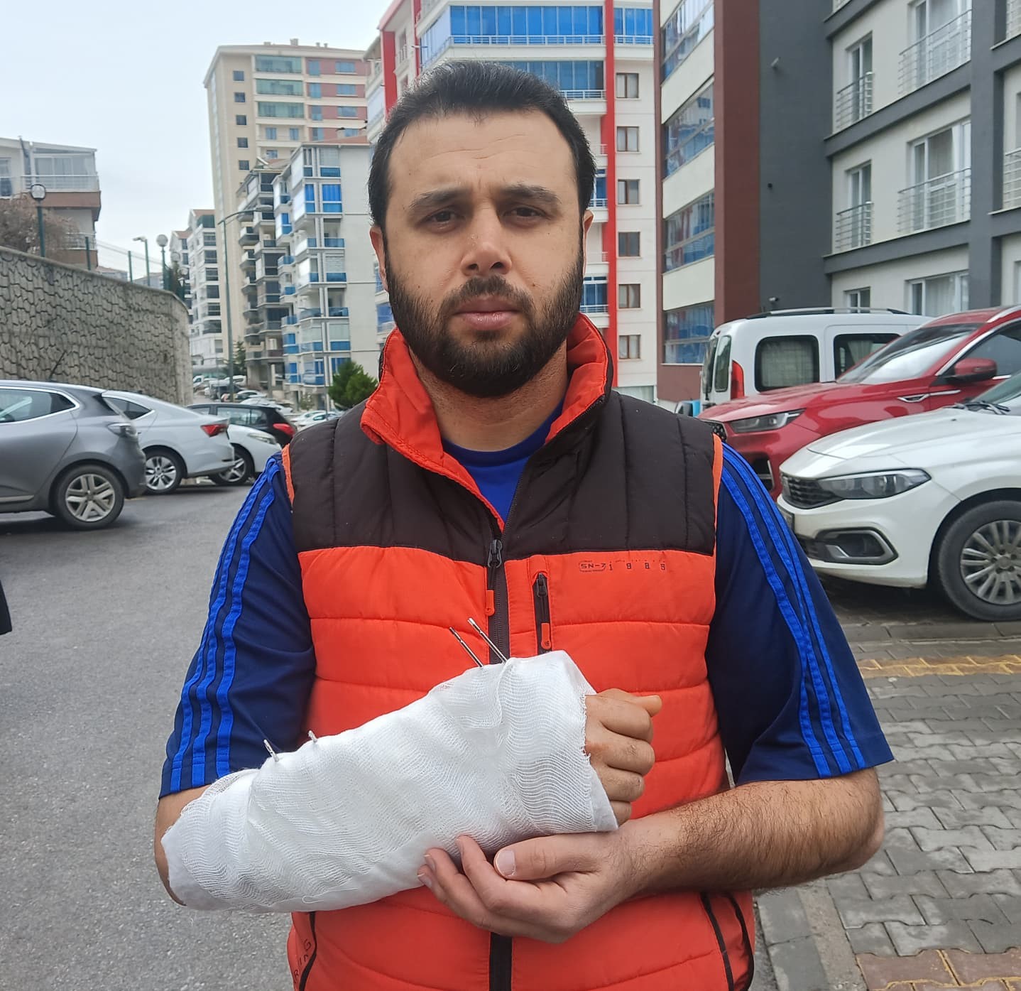 sahipsiz kopeklerin saldirisindan kacmak isterken bilegi kirildi 0 R6wINiqJ