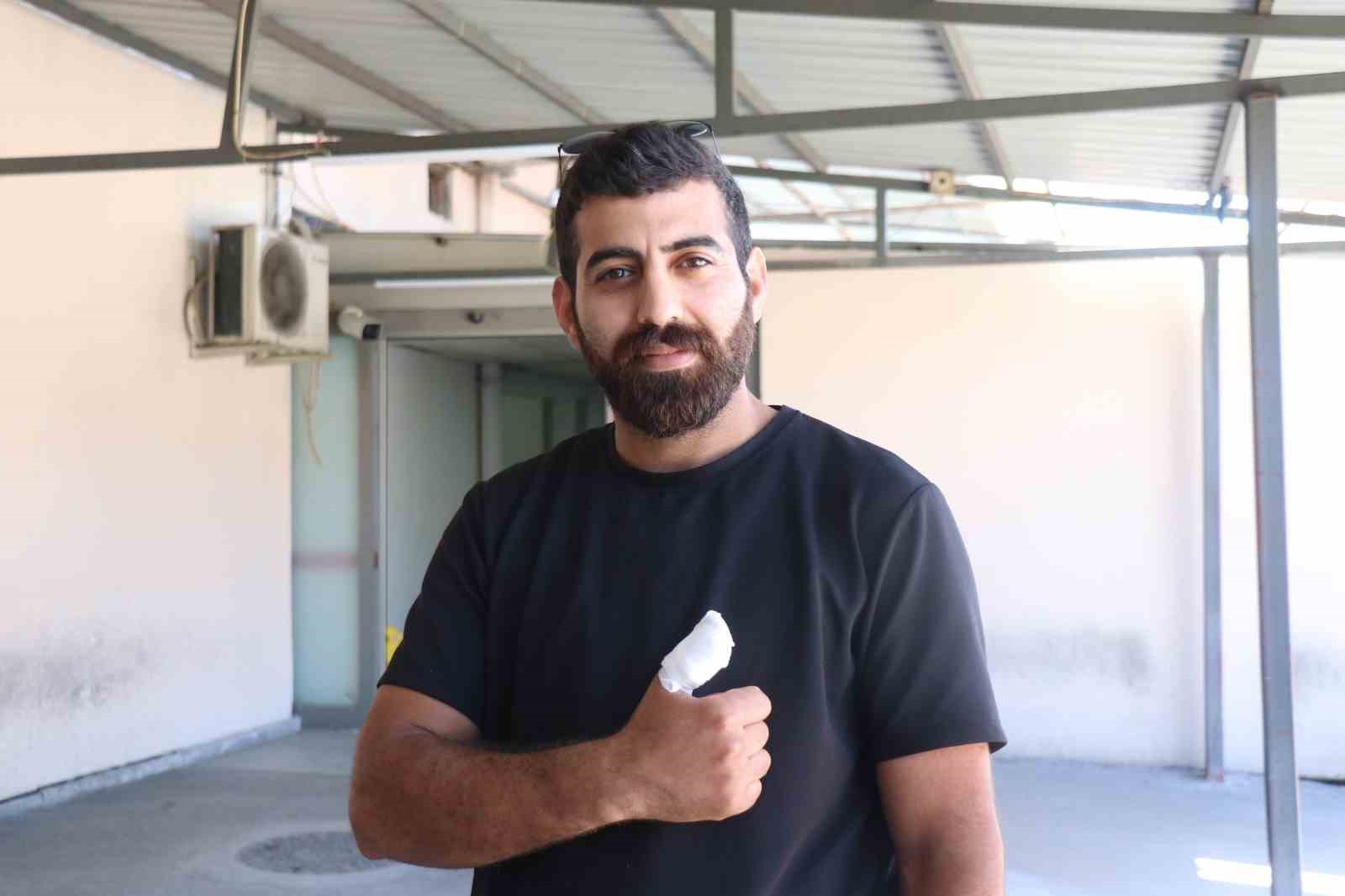 sakaryada acemi kasaplar acilleri doldurdu amca beni yaktin 1 U7AAU174