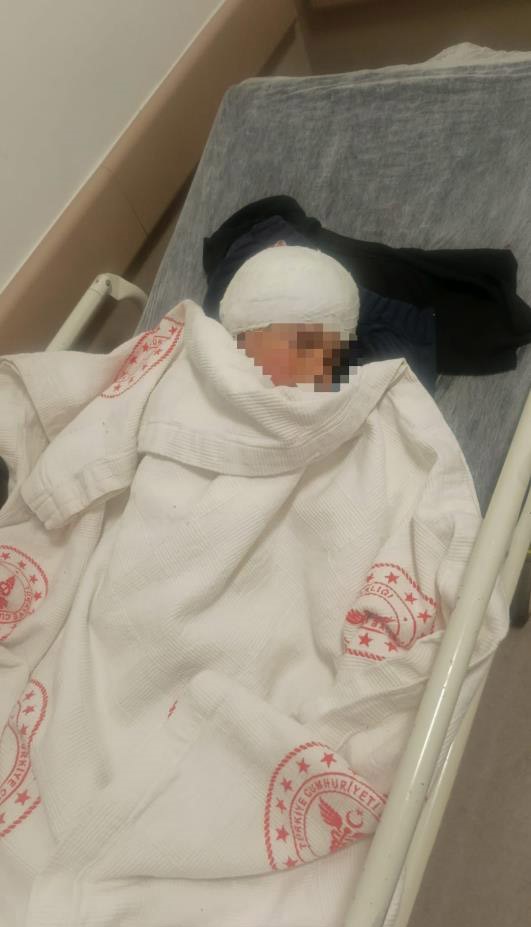 saldirgan kopegin resm olmayan sahibi ortaya cikti 3 ai17bjPw