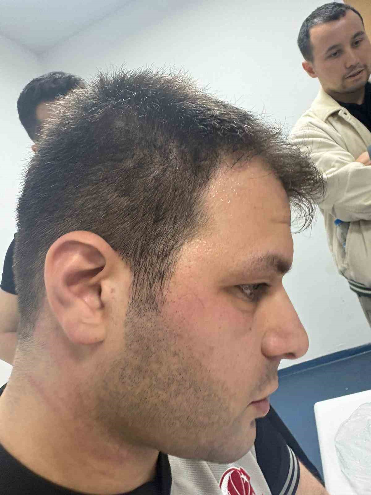 samsunda basketbol macinda oyuncu hakeme saldirdi 2 i5tzbfLj