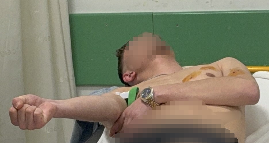 Samsun’da pompalı tüfekli saldırı: 2 yaralı 7 samsunda pompali tufekli saldiri 2 yarali 3 cvRCjgWS