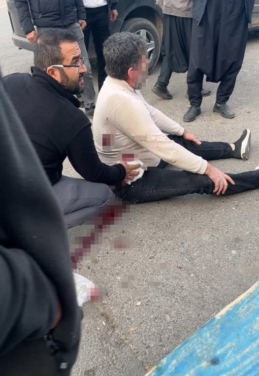 sanliurfada bicakli kavga 1 yarali 0 cZqDBCsY