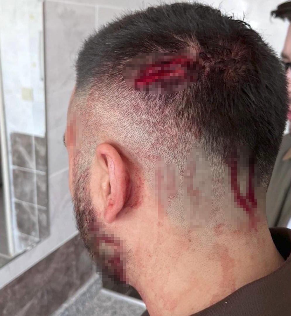 sanliurfada ogretmen veli tarafindan sopayla darbedildi 2 Zrd9AYtI