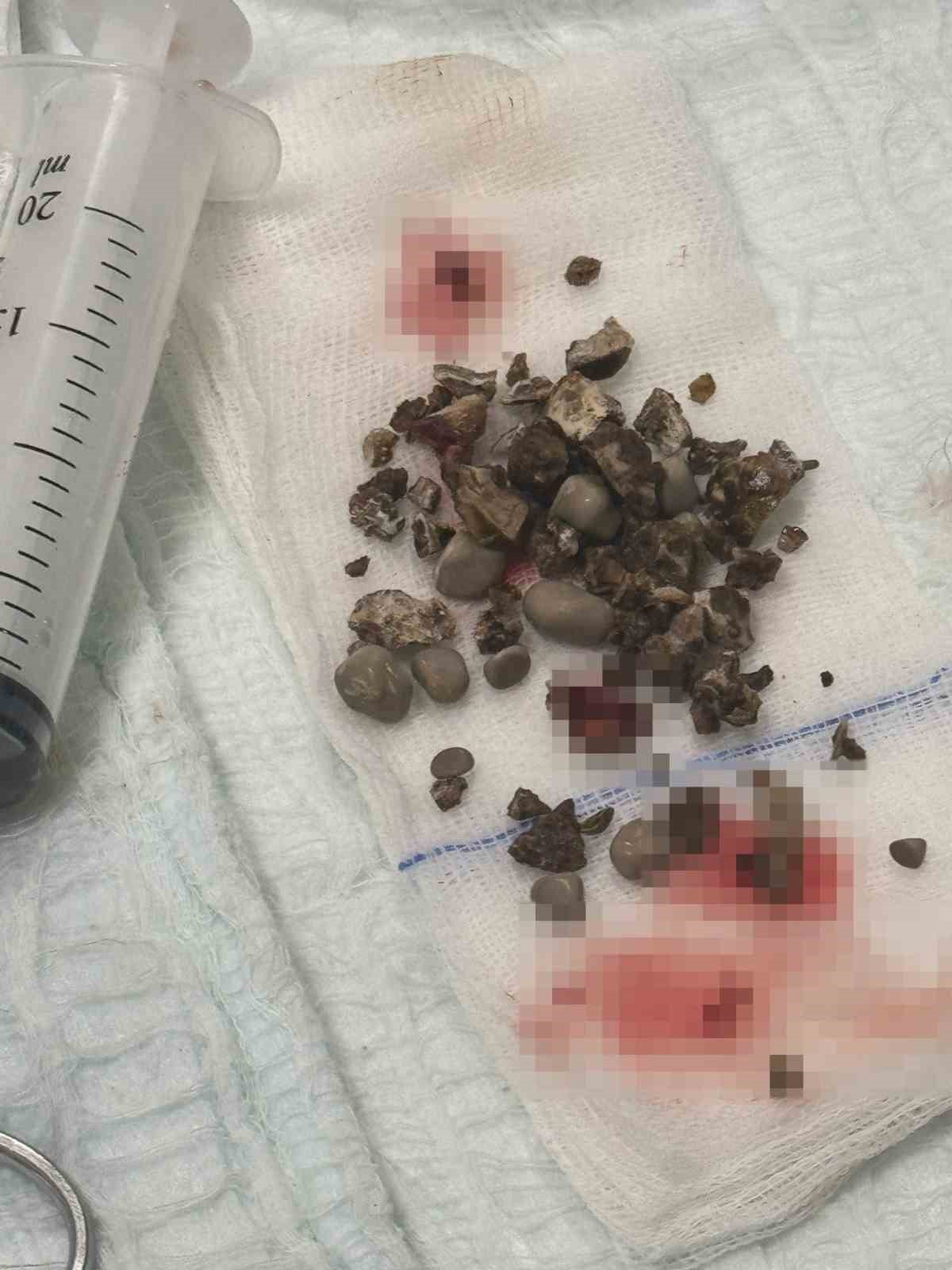 siirtte bobrek tasi hastasina nokta atisi mudahale 2 9aKIeYhF
