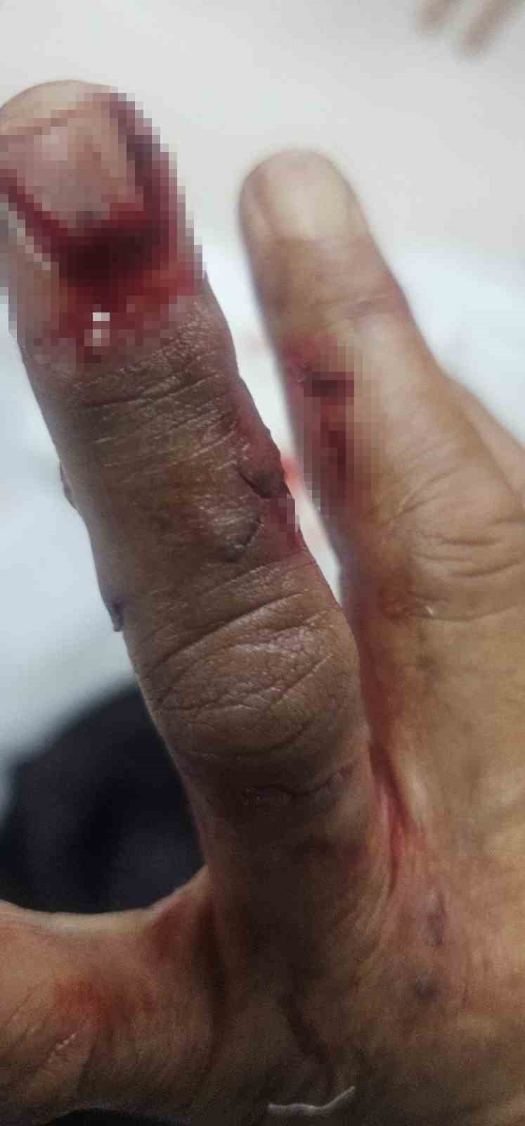 sirnakta basibos kopek dehseti 3 kisi yaralandi 2 P8z7BpXm