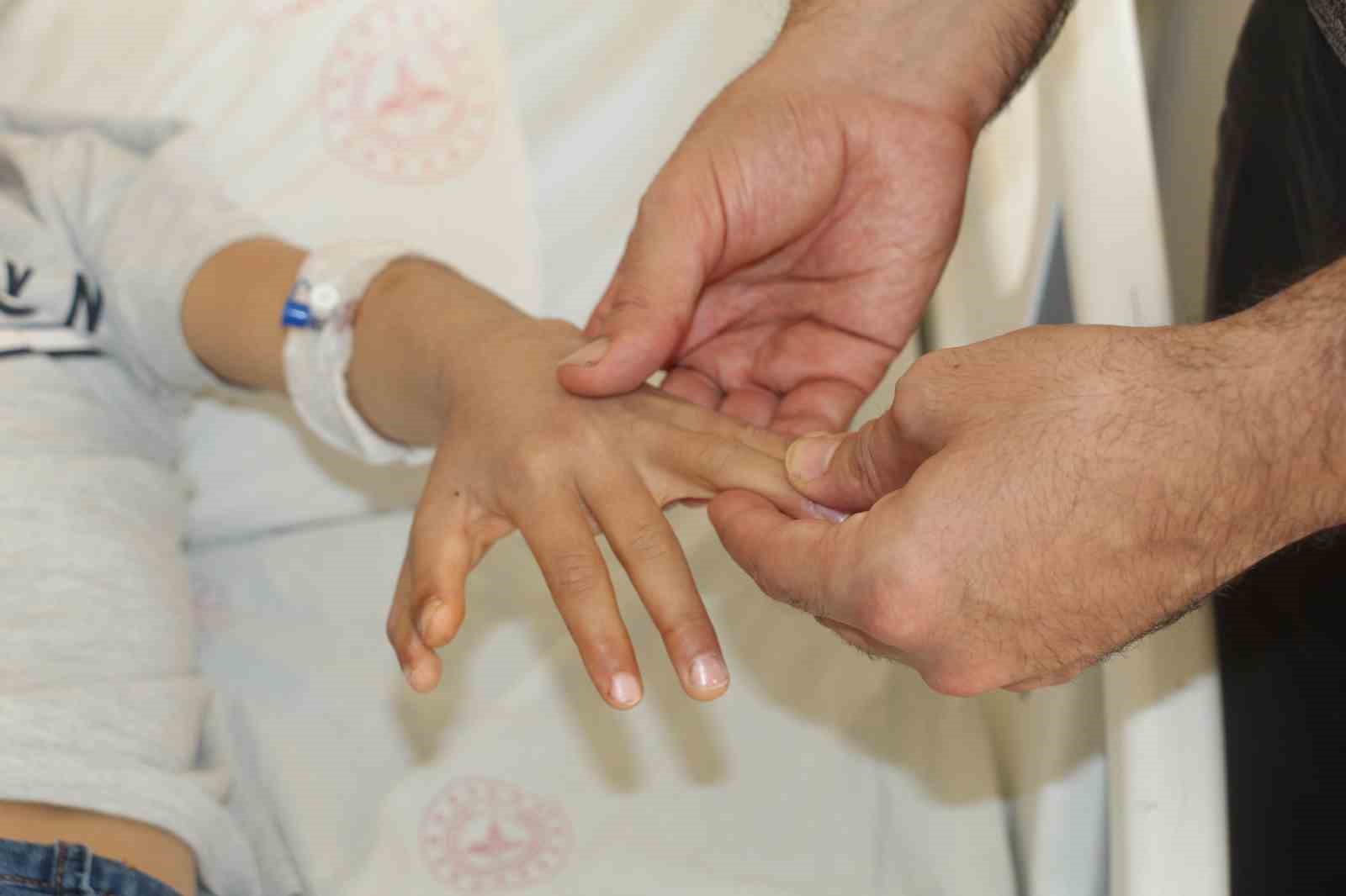 Şırnak’ta yapışık parmaklı iki kardeş ameliyatla sağlıklarına kavuştu 4 sirnakta yapisik parmakli iki kardes ameliyatla sagliklarina kavustu 0 JCJNAIi2