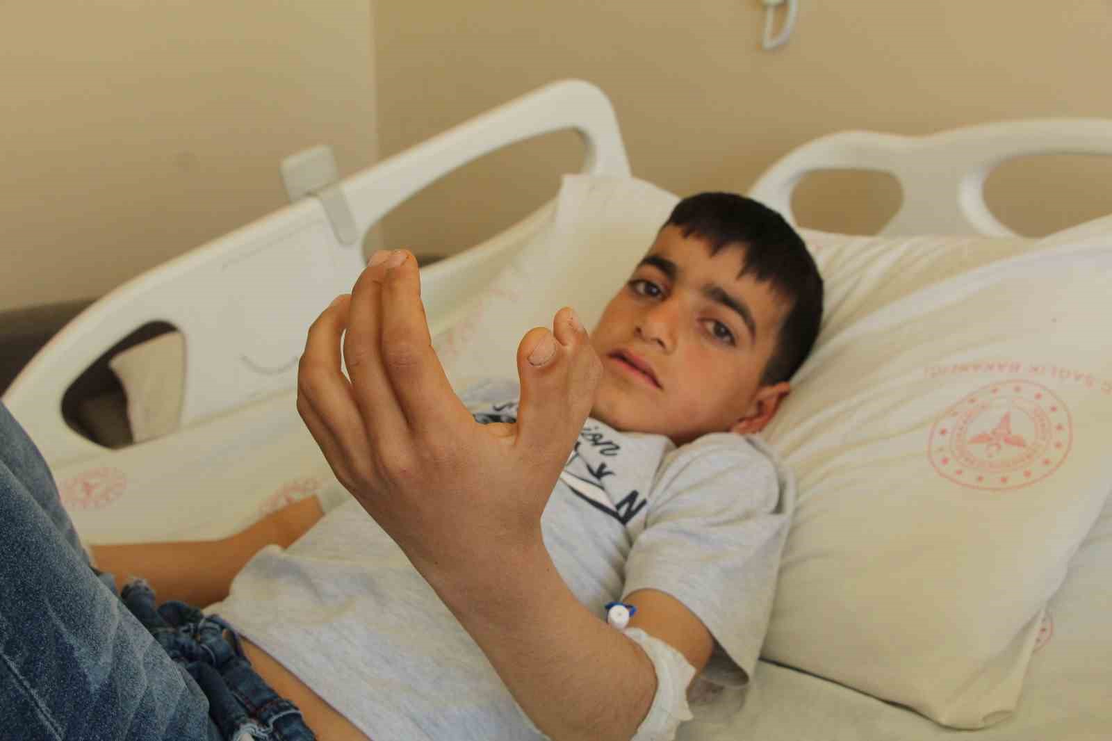 Şırnak’ta yapışık parmaklı iki kardeş ameliyatla sağlıklarına kavuştu 5 sirnakta yapisik parmakli iki kardes ameliyatla sagliklarina kavustu 1 vlCaR6OF