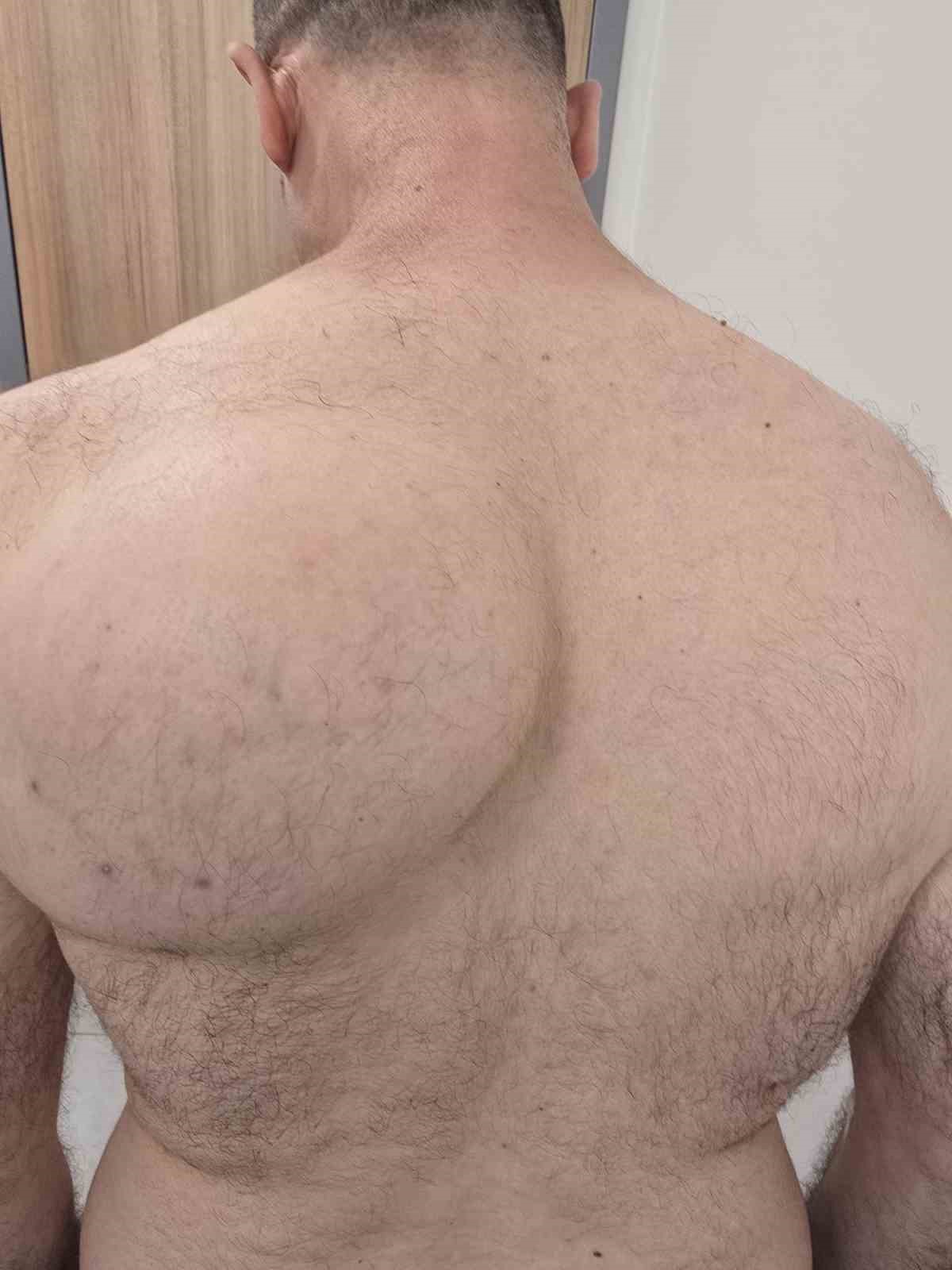 sirtindaki 10 yillik kitlenin icinden 1 bucuk kilogramlik tumor cikti 4 q7iYVtuK